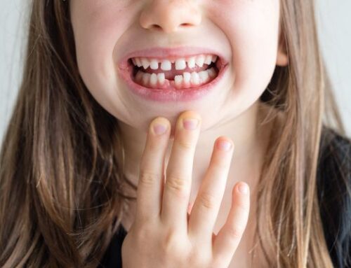 Dentes fracos e sensíveis? Estudo traça origens na infância